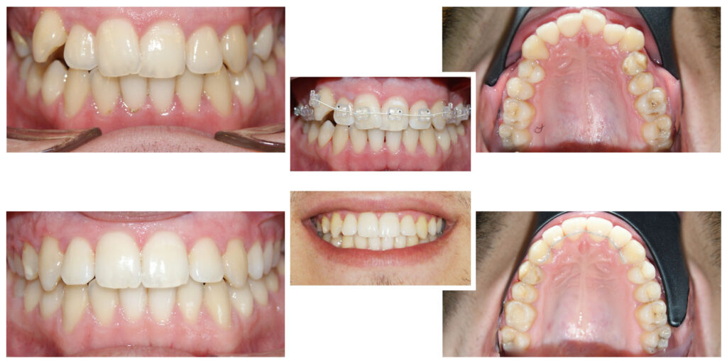 Câtă încredere poate radia un zâmbet corect