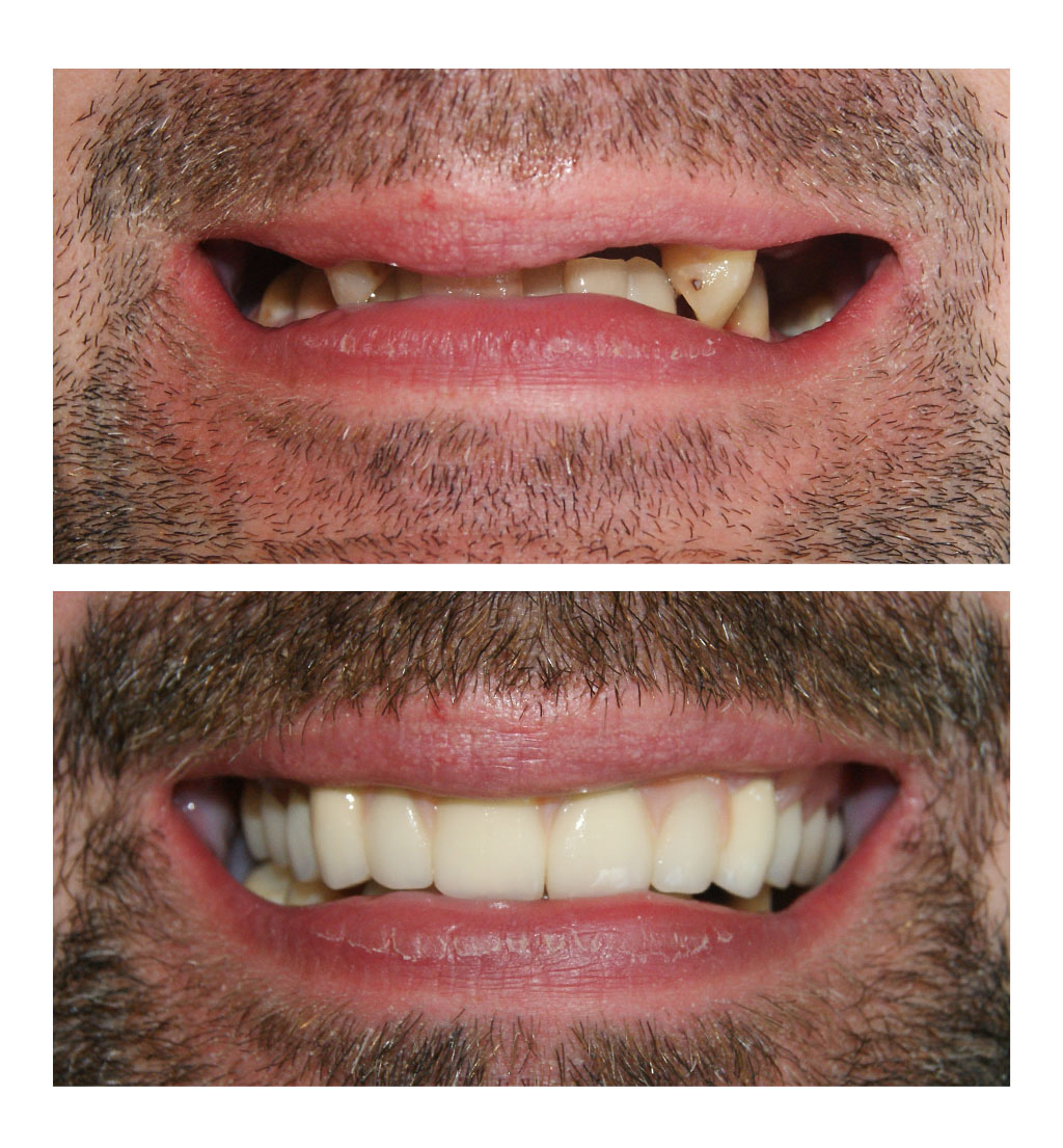 Tehnician – Happy 3Dent