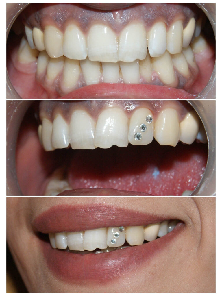 De 3 ori BLINK Swarowski