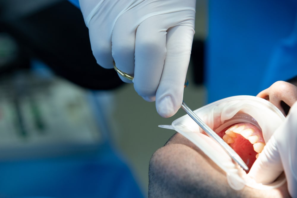 Chirurgie dentară